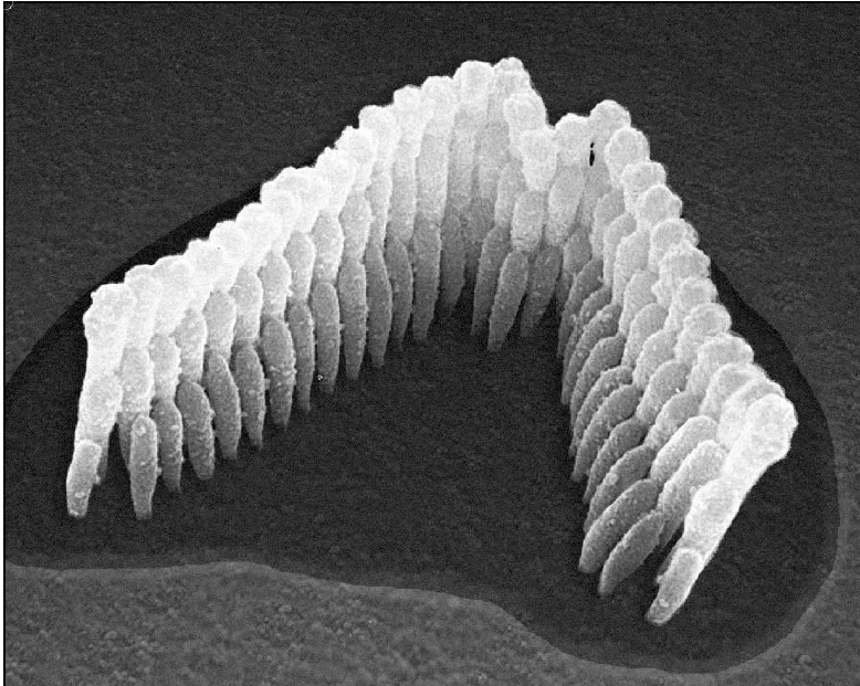 Microscopic image of healthy stereocilia, also called hair cells.