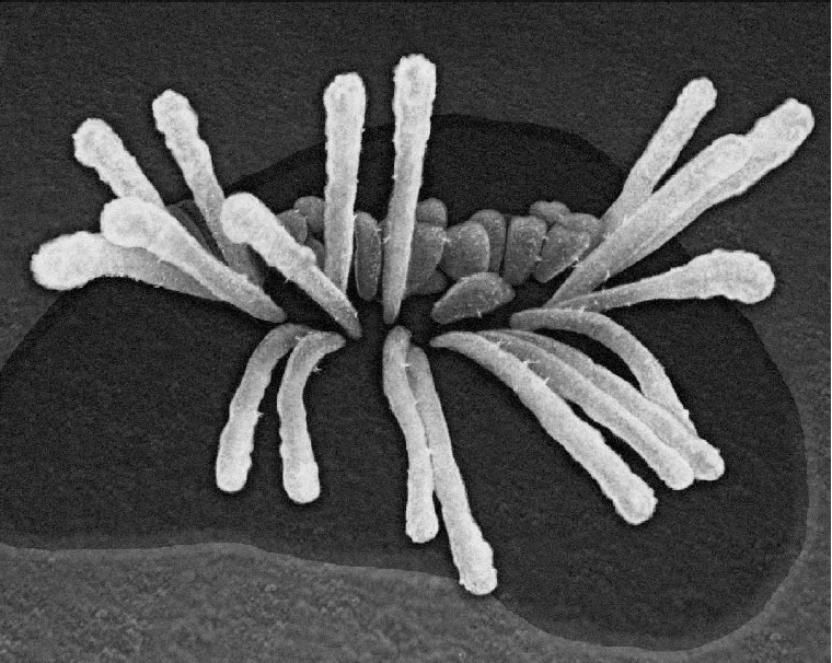 Imagen microscópica de estereocilios que han sido dañados.