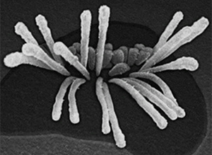 Imagen microscópica de un paquete de esteocilios dañado.