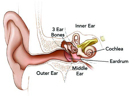 Illustration of the parts of the human ear, showing the outer ear, the middle ear, the inner ear, the eardrum, the cochlea, and the three ear bones.